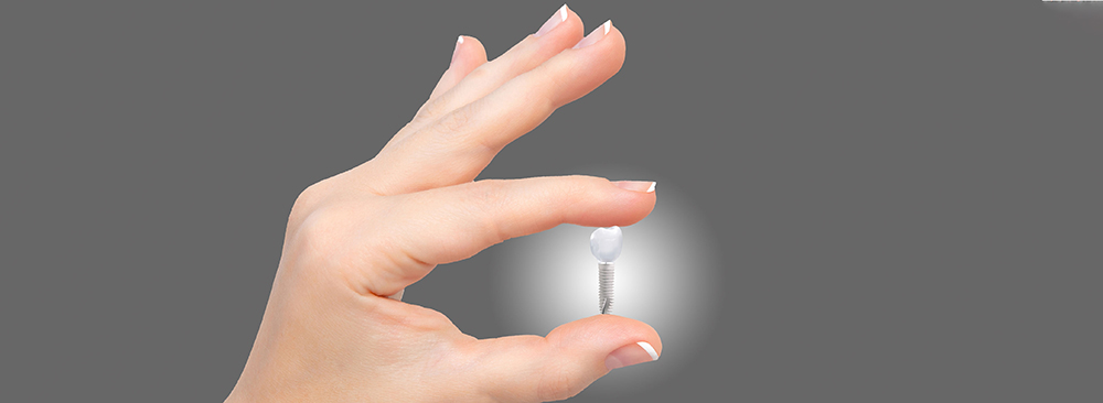 Minimalinvasive Implantologie, die schonendere Lösung für implantatgetragene Zähne.